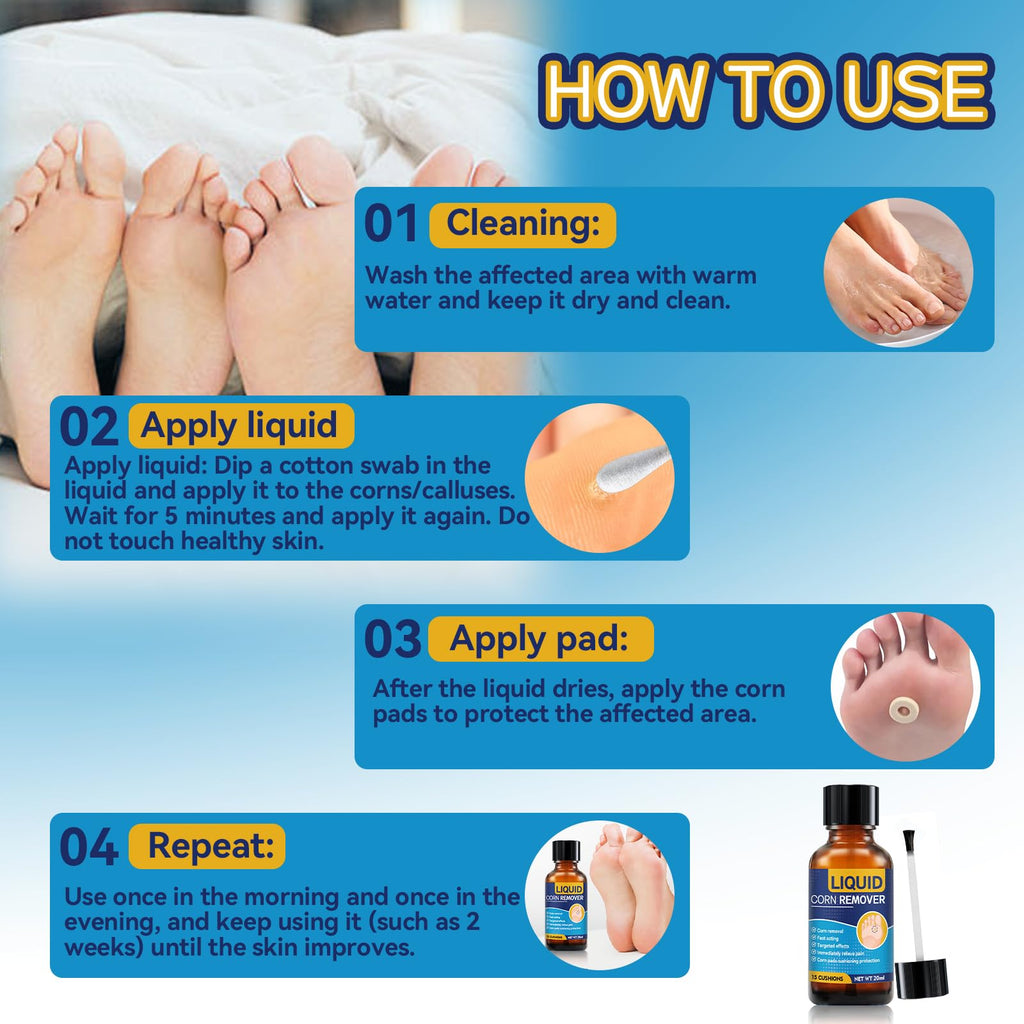 Extra Strength Liquid Corn Remover for Feet - Fast Acting 20ml 1-Pack - Damaged Box