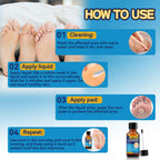 Extra Strength Liquid Corn Remover for Feet - Fast Acting 20ml 1-Pack - Damaged Box