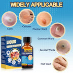 Extra Strength Liquid Corn Remover for Feet - Fast Acting 20ml 1-Pack - Damaged Box