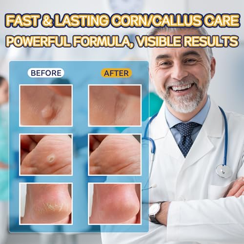 Extra Strength Liquid Corn Remover for Feet - Fast Acting 20ml 1-Pack - Damaged Box