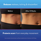 ScarAway Scar Away Scar Repair Gel With Patented Kelo-Cote Technology, 20 Grams - Damaged Box