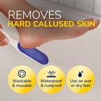 Dr. Scholl's Nano Glass Foot File - Immediately Removes Hard Skin on Wet or Dry Feet, Waterproof & Rustproof, Gentle Dead Skin and Callus Remover, Pedicure Foot Scrubber for Shower, Soft-Grip Handle - Damaged Box