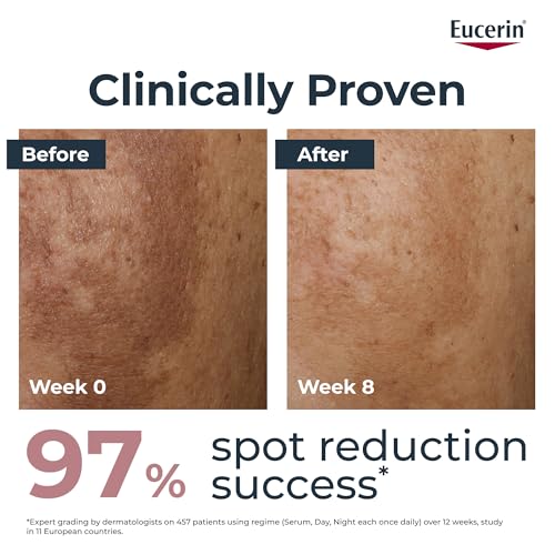 Eucerin Anti-Pigment Night Cream 50ml, Enriched Face Cream to Reduce Appearance of Age Spots, Hyperpigmentation Treatment Formula with Thiamidol to Reduce Dark Spots - Damaged Box
