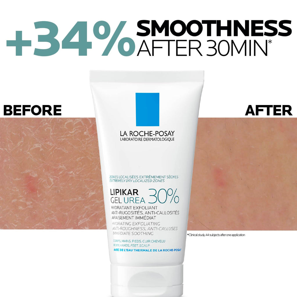 La Roche Posay Lipikar Urea 30% Exfoliating Moisturising Gel With Niacinamide, Intensive Care for Extremely Dry, Rough & Thick Localized Zones, Soothing Body Treatment, 50ml - Damaged Box