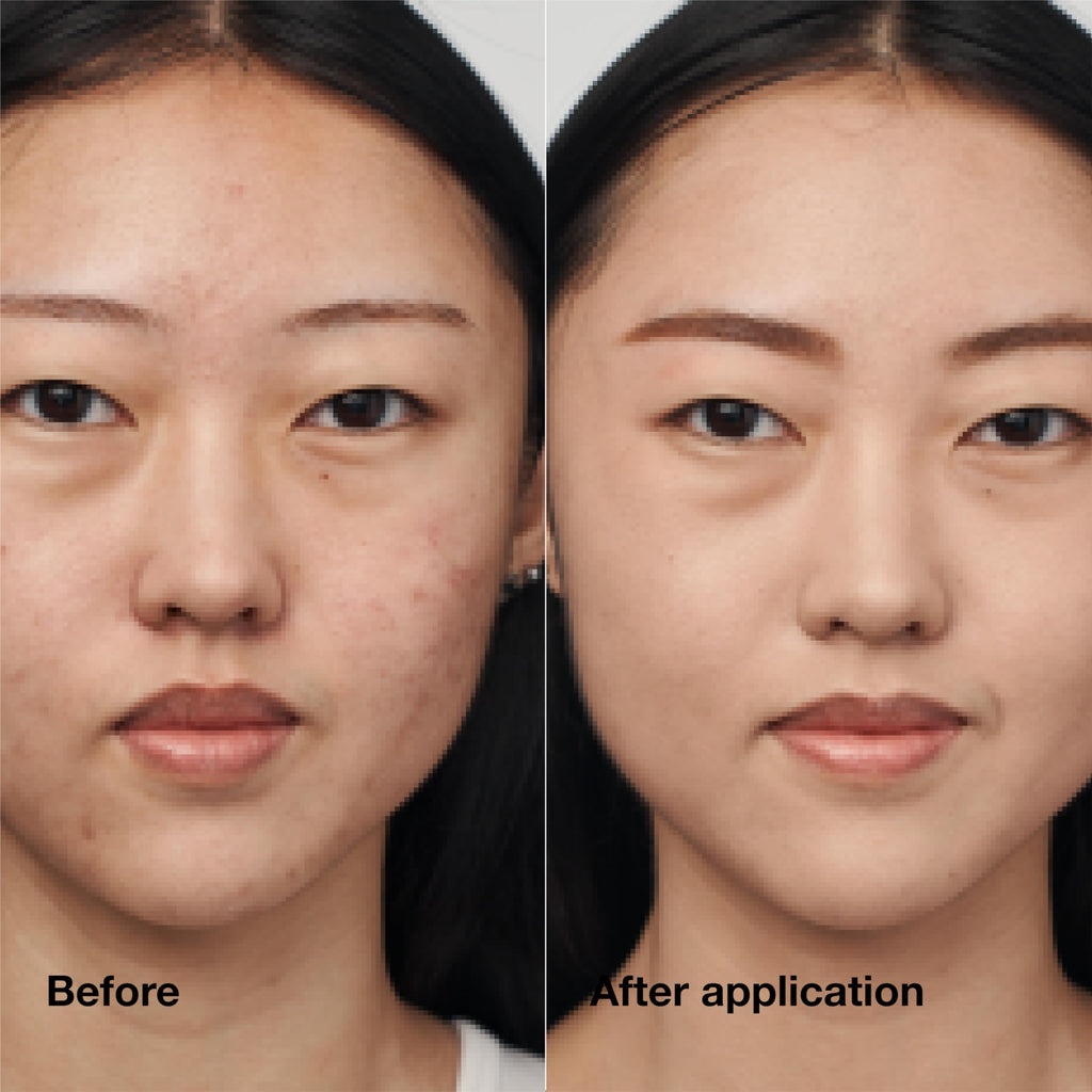 Even Better Clinical Serum Foundation SPF 20, Full Coverage, Satin Matte Finish With 3 Serum Technology, 1.01442 fl oz - Damaged Box