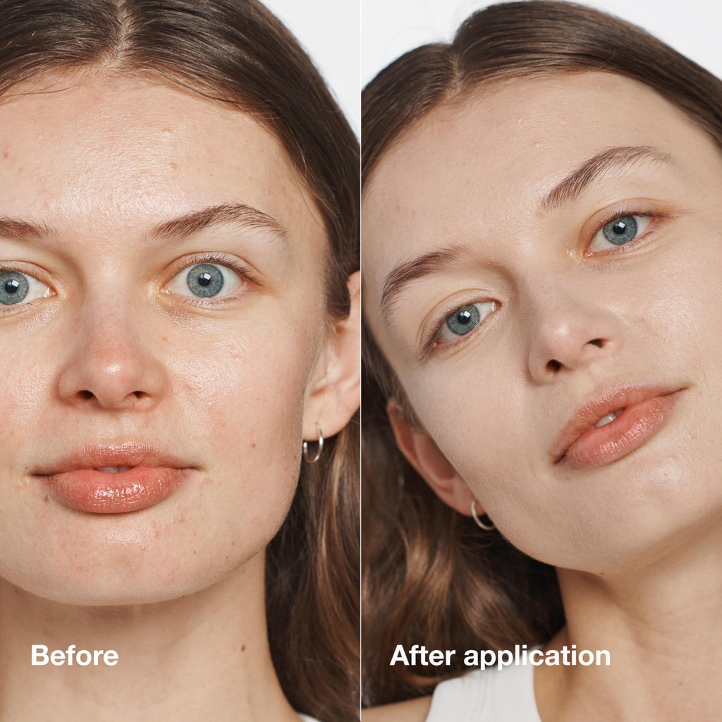 Clinique Even Better Makeup Foundation SPF 15 - WN 01 Flax - Medium Coverage, Evens Skin Tone, Reduces Dark Spots, 30ml - Damaged Box
