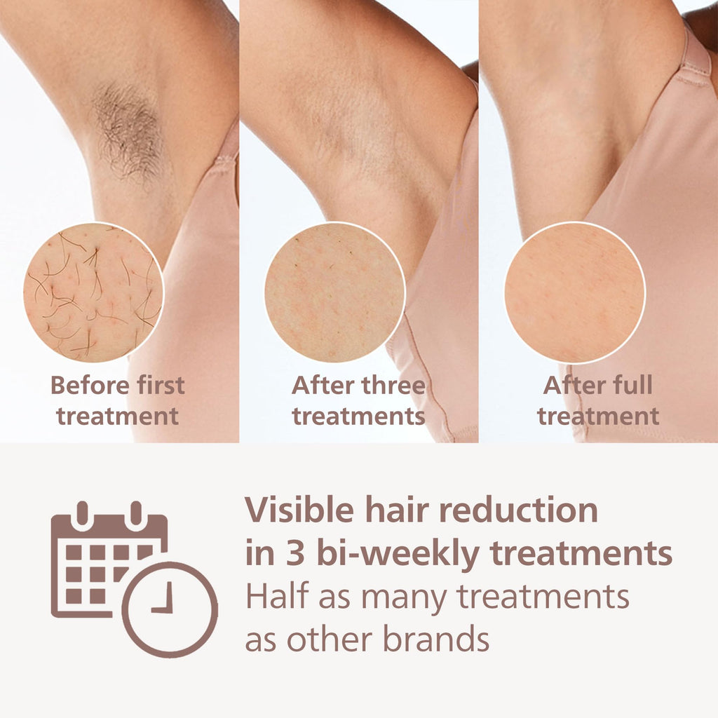 Philips Lumea IPL Hair Removal 8000 Series - Hair Removal Device with SenseIQ Technology, 4 Attachments for Body, Face Bikini and Underarm, Corded Use (Model BRI948/00)