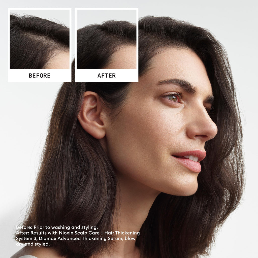 Nioxin Scalp + Hair Thickening System 3 Loyalty Kit - Hair Thickening System for Coloured, Dry and Damaged Hair with Light Thinning - Shampoo, Conditioner and Scalp Treatment, 300+300+100ml - Damaged Box