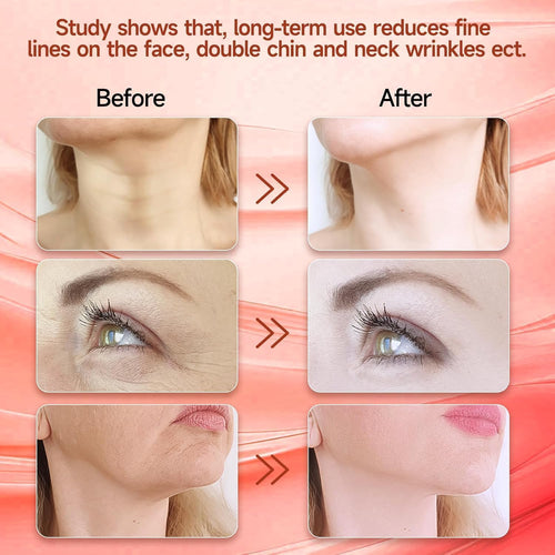 7-in-1 Face Massager with Heat & LED - Facial Sculpting Tool for Neck & Jawline - Skin Tightening & Anti-Wrinkle Device - Damaged Box