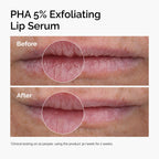 The Ordinary PHA 5% Exfoliating Lip Serum, Hydrating Overnight Lip Exfoliator Treatment, 15ml - Damaged Box