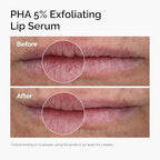 The Ordinary PHA 5% Exfoliating Lip Serum, Hydrating Overnight Lip Exfoliator Treatment, 15ml - Damaged Box
