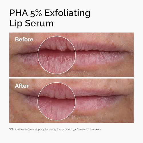 The Ordinary PHA 5% Exfoliating Lip Serum, Hydrating Overnight Lip Exfoliator Treatment, 15ml - Damaged Box