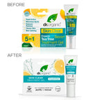 Dr Organic Skin Clear 5-in-1 Treatment Gel - Salicylic Acid, Oily Skin, Vegan, 10ml
