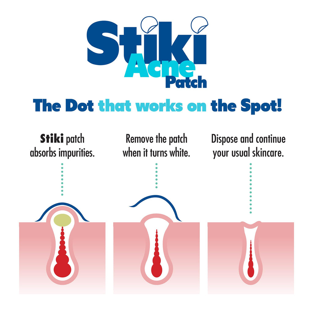 Stiki Acne Patches (36 Pack) - 12mm Hydrocolloid Pimple Patches for Spots & Blemishes, Invisible Acne Spot for Day & Night Use