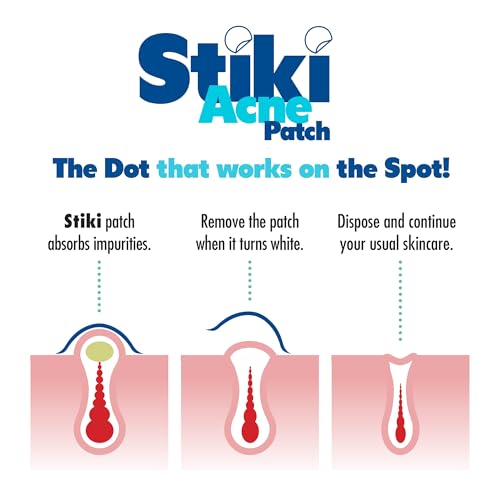 Stiki Acne Patches (36 Pack) - 12mm Hydrocolloid Pimple Patches for Spots & Blemishes, Invisible Acne Spot for Day & Night Use
