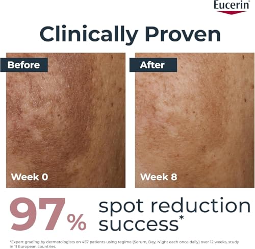 Eucerin Anti-Pigment Day Cream SPF 30 50ml, Hyperpigmentation Treatment with Thiamidol to Reduce and Prevent Dark Spots, Nourishing Face Cream with SPF 30 for UVA/UVB Protection - Damaged Box