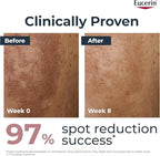 Eucerin Anti-Pigment Day Cream SPF 30 50ml, Hyperpigmentation Treatment with Thiamidol to Reduce and Prevent Dark Spots, Nourishing Face Cream with SPF 30 for UVA/UVB Protection - Damaged Box