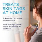 Scholl Complete Care Skin Tag Removal Kit - Safe & Effective Skin Tag Remover - Moisturising Serum Restores Skin's Appearance - Clinically Proven - 12 Treatments Plus Hydrating Serum - Damaged Box - BBE 04/2027