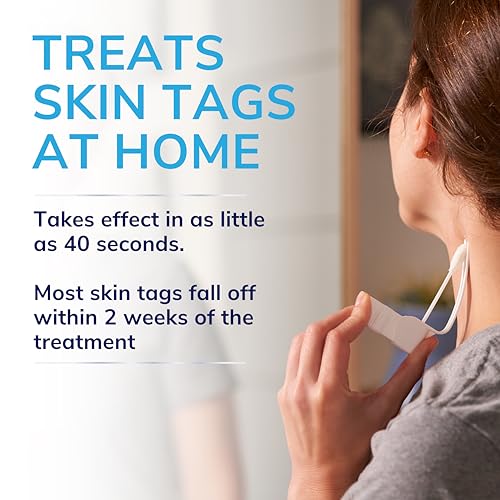 Scholl Complete Care Skin Tag Removal Kit - Safe & Effective Skin Tag Remover - Moisturising Serum Restores Skin's Appearance - Clinically Proven - 12 Treatments Plus Hydrating Serum - Damaged Box - BBE 04/2027
