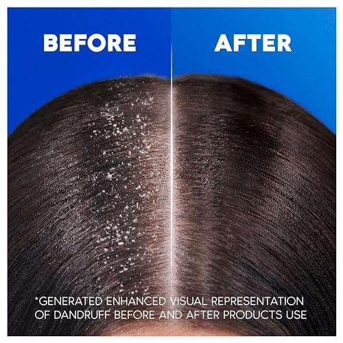 Head & Shoulders Apple Fresh Anti-Dandruff Shampoo 1000ml - Flake Free Daily Use for All Hair Types - New