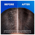 Head & Shoulders Apple Fresh Anti-Dandruff Shampoo 1000ml - Flake Free Daily Use for All Hair Types - New