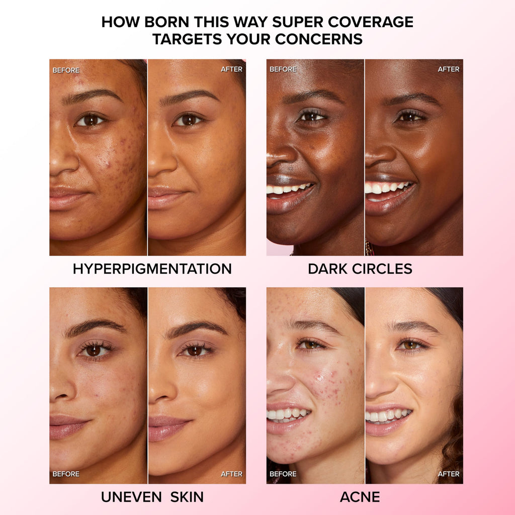 Too Faced Born This Way Super Coverage Multi-Use Concealer (Snow)| Full Coverage, Oil Free, Long Lasting + Hydrating - Damaged Box