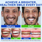 Hydroxyapatite Toothpaste - 7.5% Hydroxyapatite, Enamel Protection, Fluoride-Free, Gentle Mint, 240g 2-Pack - Damaged Box - BBE 03/2028