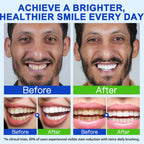 Hydroxyapatite Toothpaste - 7.5% Hydroxyapatite, Enamel Protection, Fluoride-Free, Gentle Mint, 240g 2-Pack - Damaged Box - BBE 03/2028