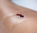 Silicnet Silicone Net Dressing Non-Adherent, Flexible, and Breathable Dressing for Delicate Skin - Ideal for Surgical Wounds 10x7.5cm 5pc - Damaged Box