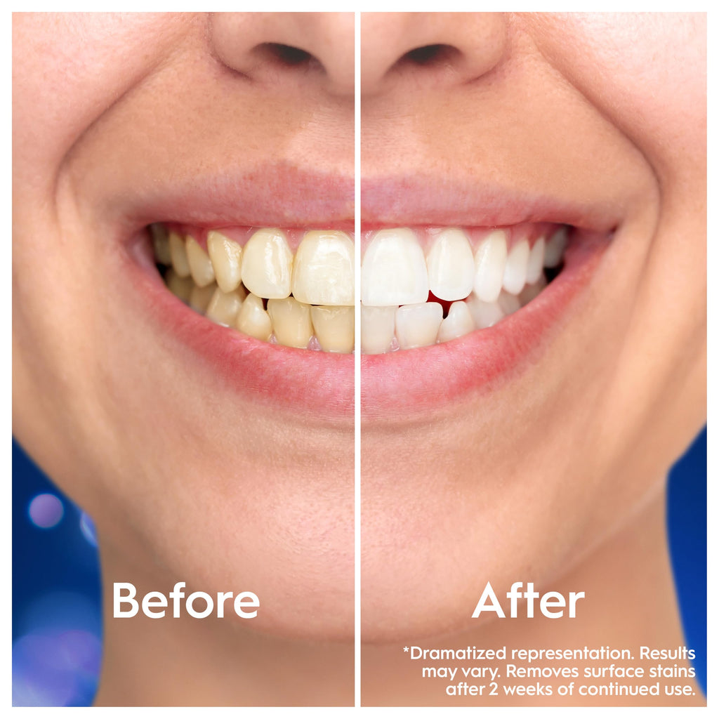 Oral-B Pro-3D White Clinical Intensive Whitening Toothpaste - Radiant White 75ml - Dental Care - Damaged Box - BBE 01/2028