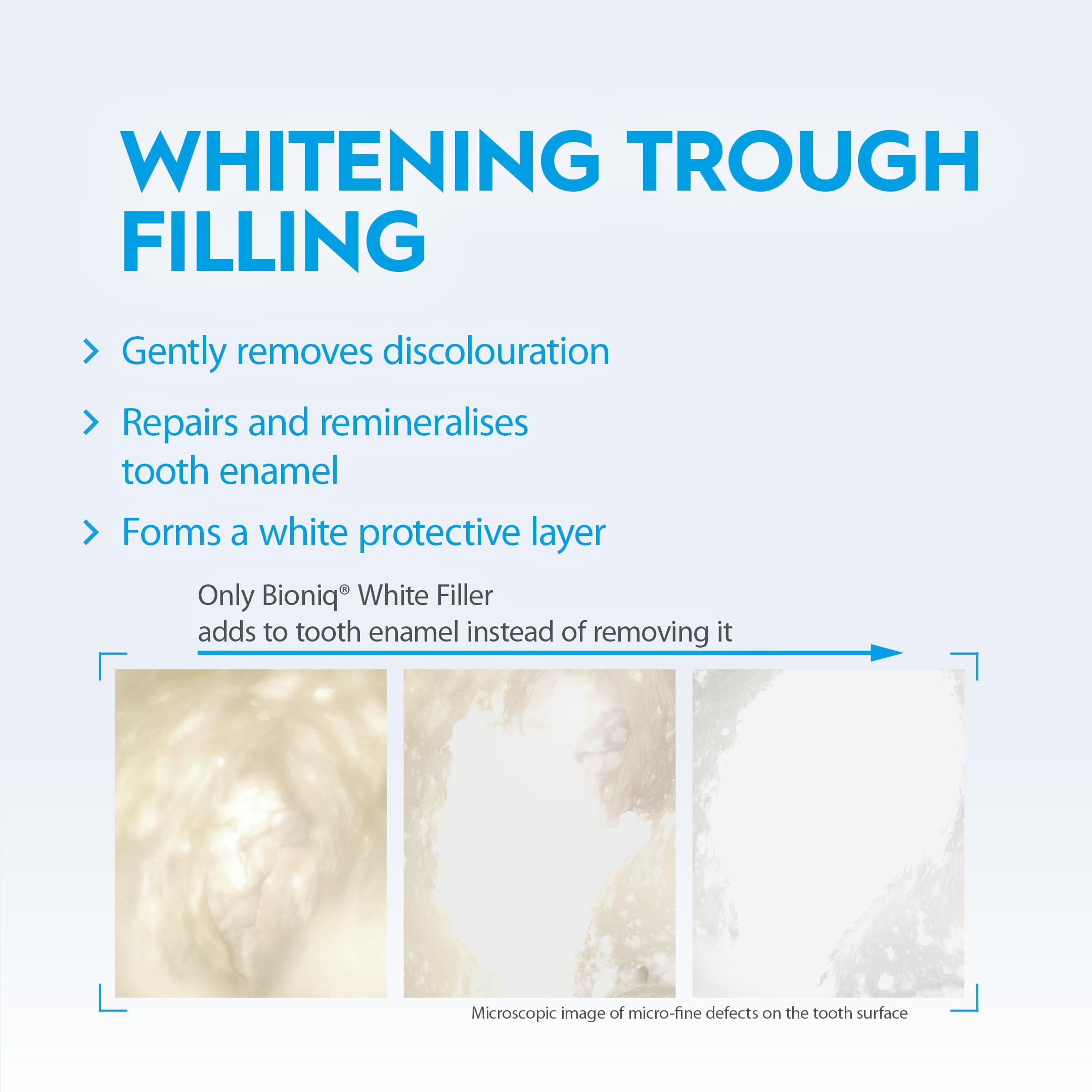 Bioniq(R) White Filler Toothpaste - 1 x 100 ml - Gentle Whitening Toothpaste with Hydroxyapatite - Protects and Strengthens Enamel - for Smooth and White Teeth - Gently Removes Stains, Fluoride-Free - Damaged Box