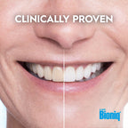 Bioniq(R) White Filler Toothpaste - 1 x 100 ml - Gentle Whitening Toothpaste with Hydroxyapatite - Protects and Strengthens Enamel - for Smooth and White Teeth - Gently Removes Stains, Fluoride-Free - Damaged Box