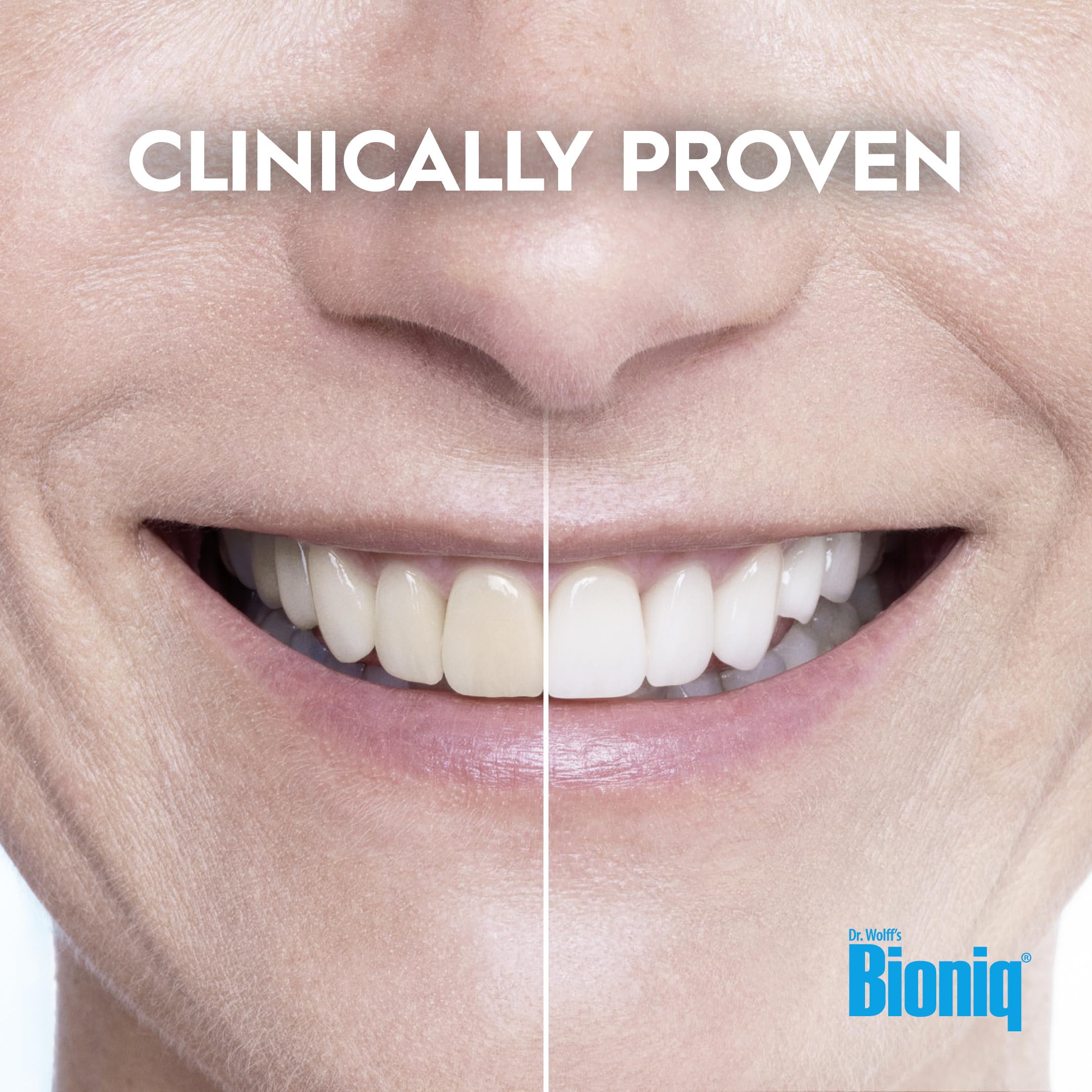 Bioniq(R) White Filler Toothpaste - 1 x 100 ml - Gentle Whitening Toothpaste with Hydroxyapatite - Protects and Strengthens Enamel - for Smooth and White Teeth - Gently Removes Stains, Fluoride-Free - Damaged Box