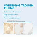 Bioniq(R) White Filler Toothpaste - 1 x 100 ml - Gentle Whitening Toothpaste with Hydroxyapatite - Protects and Strengthens Enamel - for Smooth and White Teeth - Gently Removes Stains, Fluoride-Free - Damaged Box