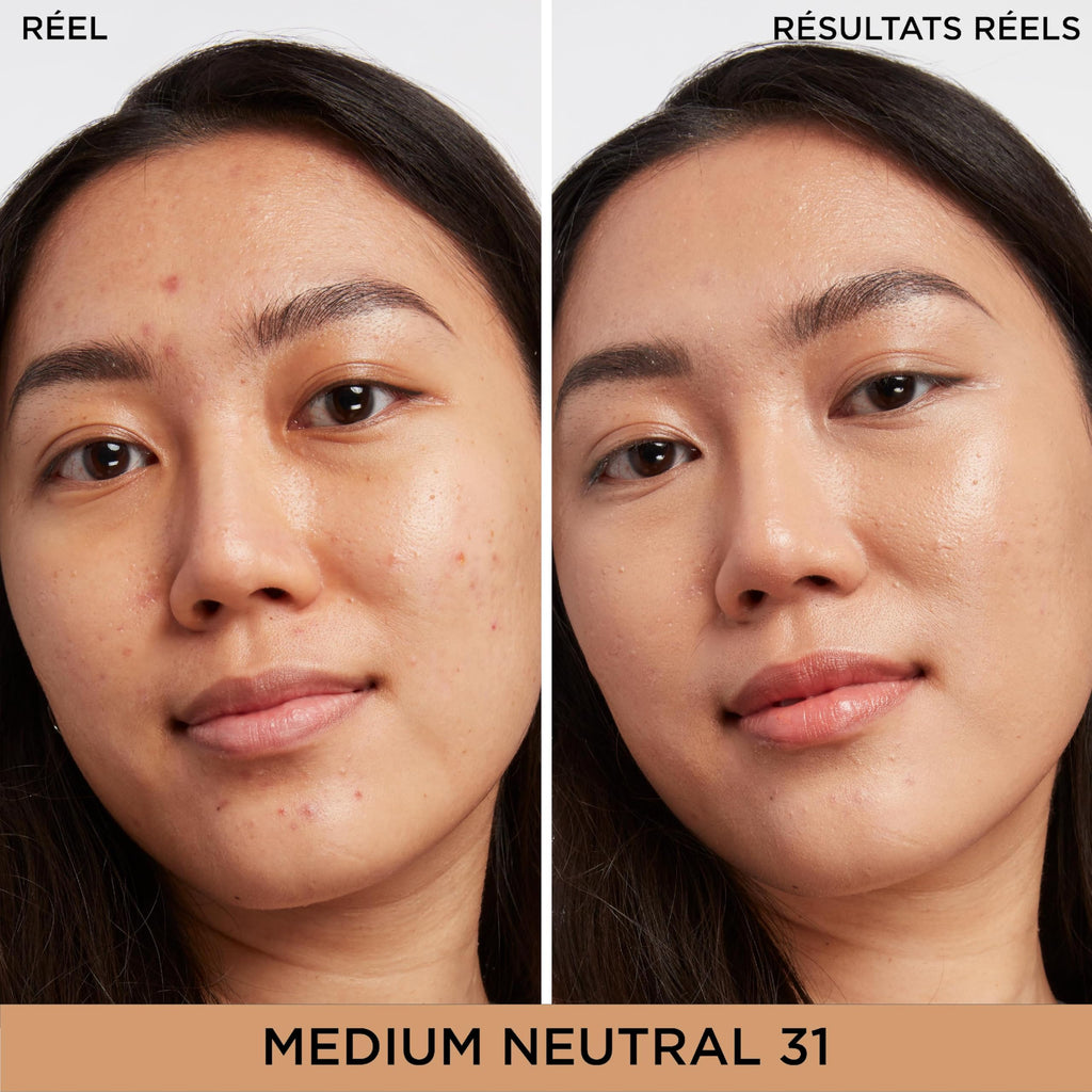 IT Cosmetics Bye Bye Dark Spots Concealer + Serum, Medium Coverage, Made with Niacinamide, Hyaluronic Acid & Caffeine, 6.7 ml - New