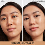 IT Cosmetics Bye Bye Dark Spots Concealer + Serum, Medium Coverage, Made with Niacinamide, Hyaluronic Acid & Caffeine, 6.7 ml - New