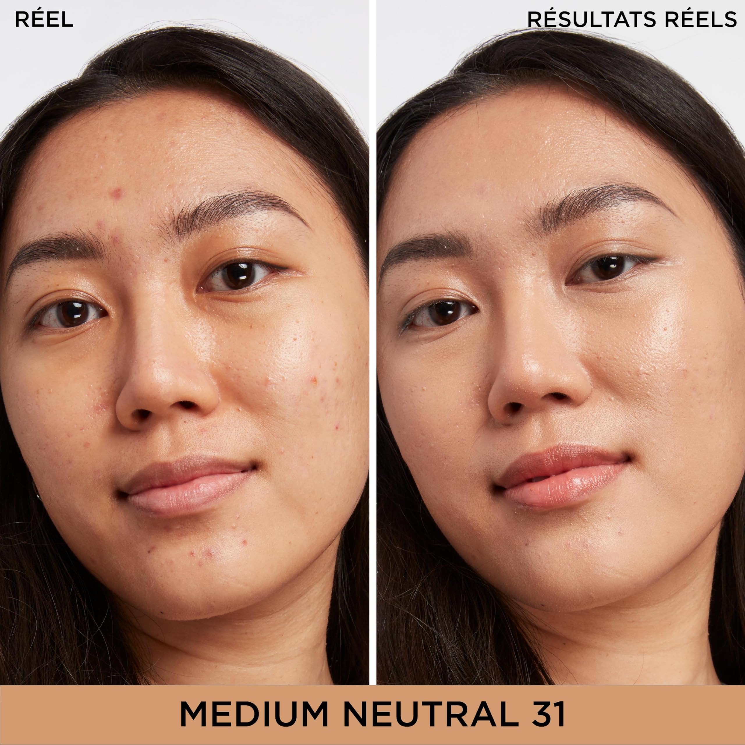 IT Cosmetics Bye Bye Dark Spots Concealer + Serum, Medium Coverage, Made with Niacinamide, Hyaluronic Acid & Caffeine, 6.7 ml - New