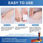 Terthon Herbal Antifungal Cream - Ringworm, Jock Itch, Athlete's Foot Treatment - Fungal Skin Infection Relief 20g 1 Pack - New - BBE 03/2028