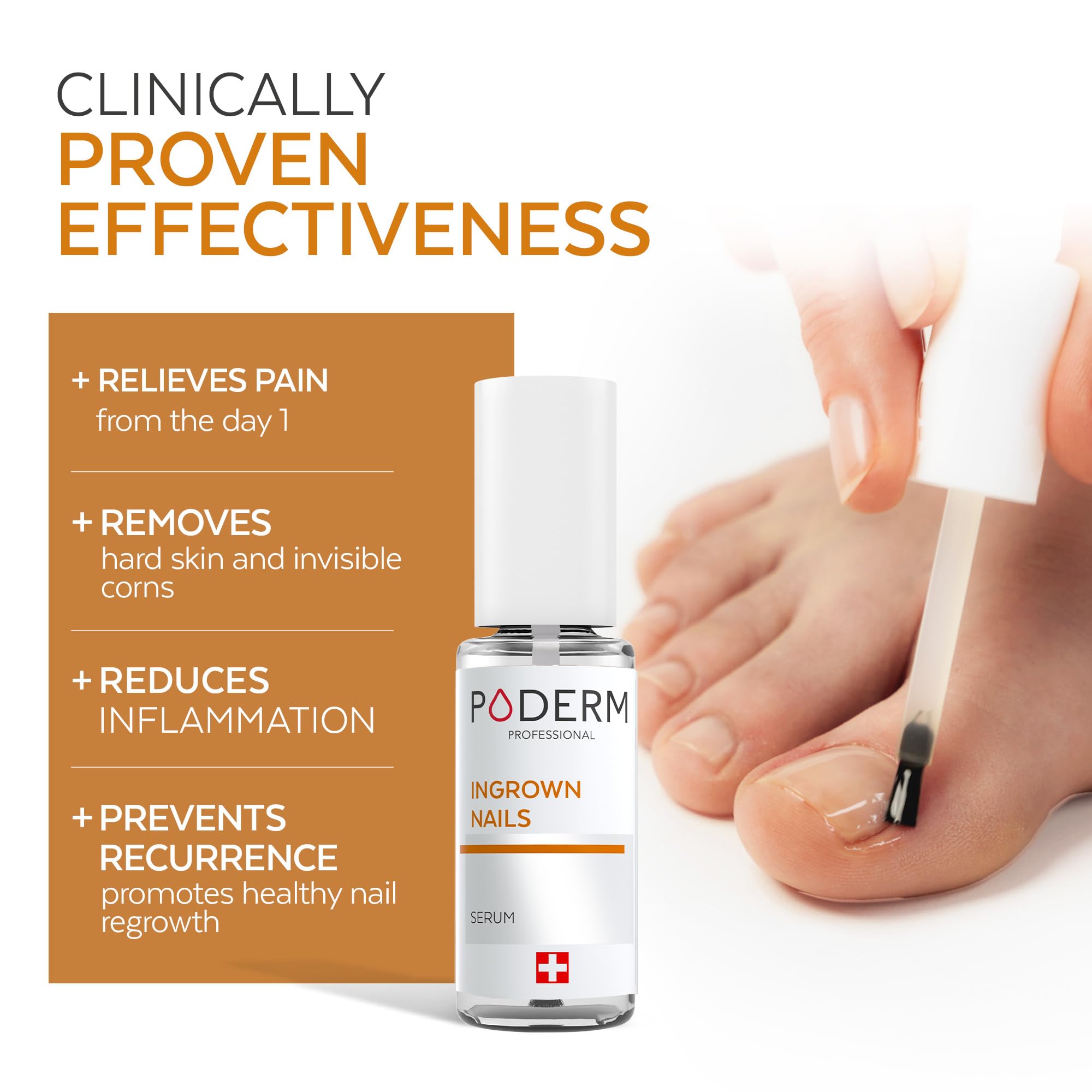Poderm Emollient Ingrown Toenail Treatment - Swiss-Made Nail Softener for Thick Curved Nails - Pain Relief, Callus Softener - Damaged Box - BBE 03/2029