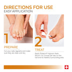 Poderm Emollient Ingrown Toenail Treatment - Swiss-Made Nail Softener for Thick Curved Nails - Pain Relief, Callus Softener - Damaged Box - BBE 03/2029