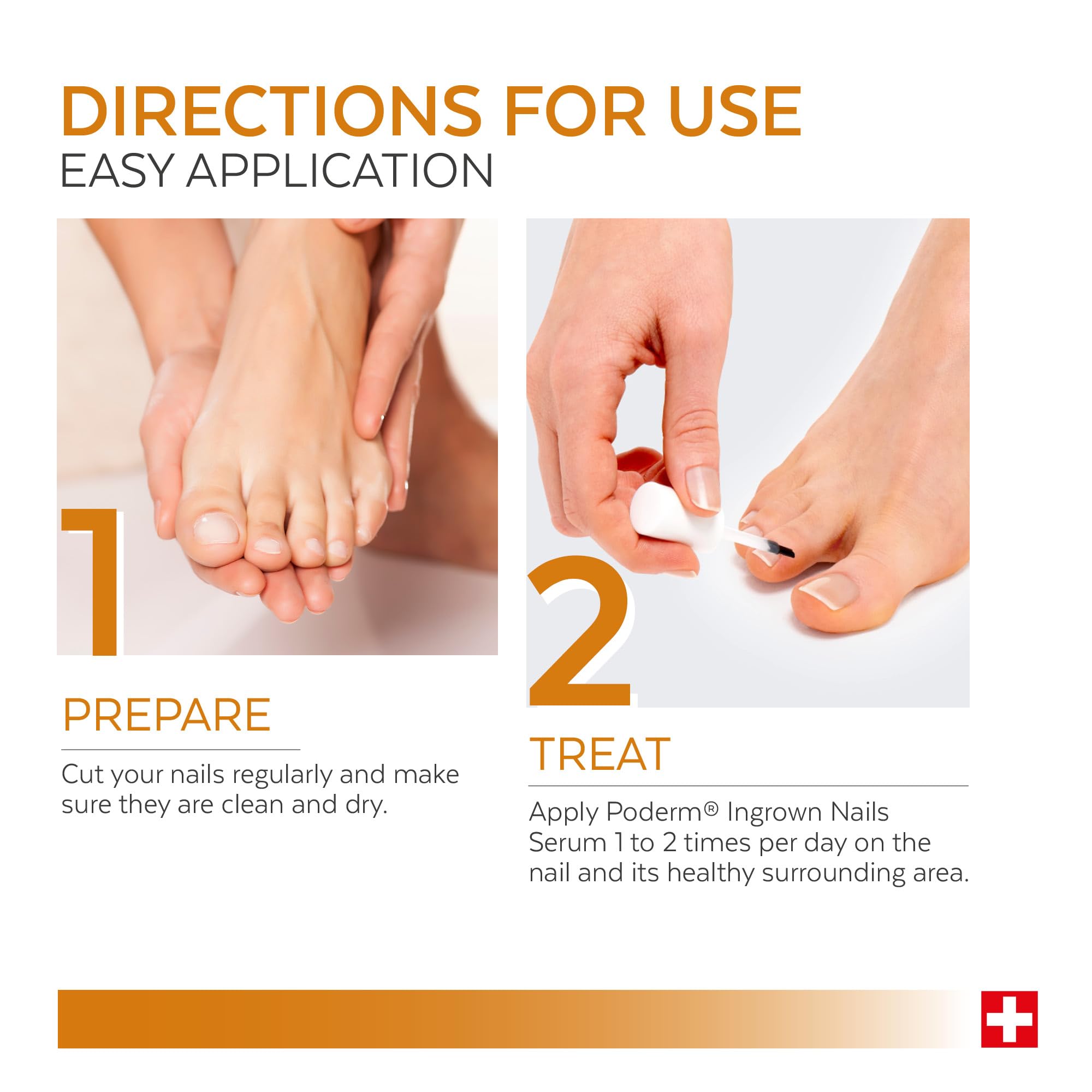 Poderm Emollient Ingrown Toenail Treatment - Swiss-Made Nail Softener for Thick Curved Nails - Pain Relief, Callus Softener - Damaged Box - BBE 03/2029