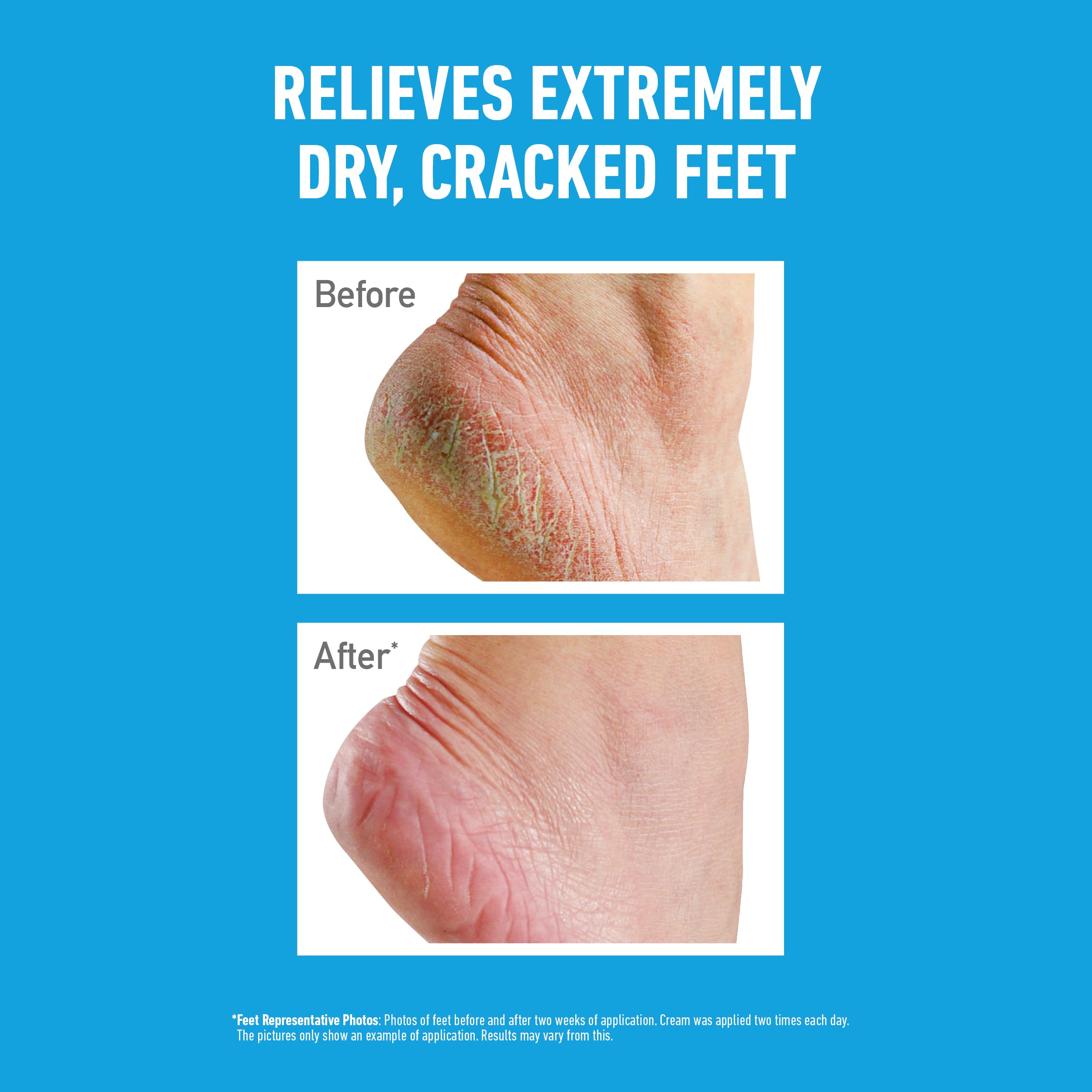 O'Keeffe's Healthy Feet Jar 91g - Foot Cream for Very Dry Skin & Cracked Heels - Boosts Moisture - Damaged Box