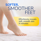 Dr. Scholl's Electric Callus Remover Pedicure Foot File - Hard Skin Exfoliator, AAA Batteries Included - Damaged Box