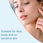 KELO-COTE Scar Gel 6g - Silicone Scar Treatment for Old & New Scars - Reduces Redness & Itching - Surgical, Burn, Acne Scars - Damaged Box - BBE 05/2029