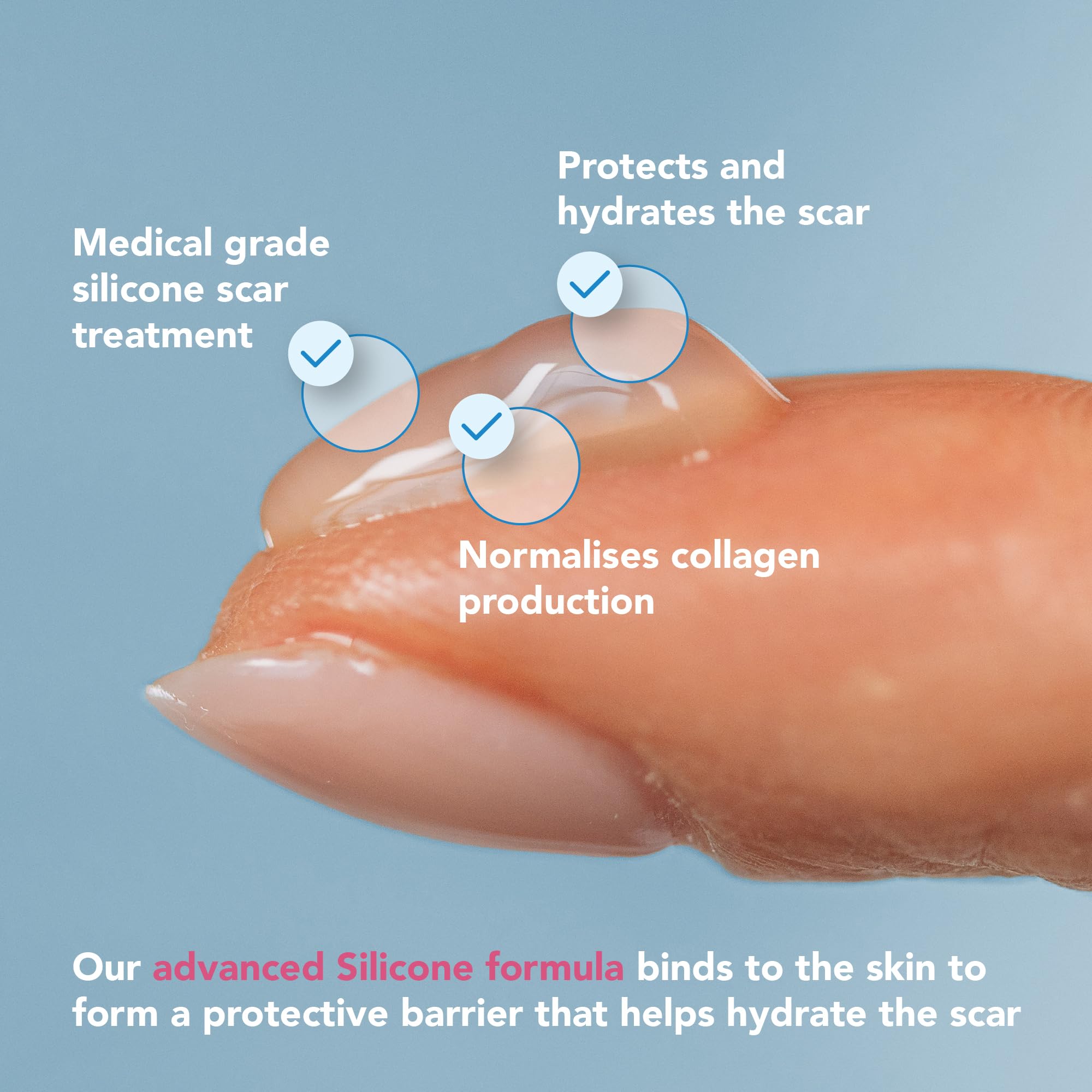 KELO-COTE Kids Silicone Scar Gel 6g - Gentle Treatment for Sensitive Skin - Reduces Raised Scars - Surgical Burn Acne - Damaged Box - BBE 09/2026
