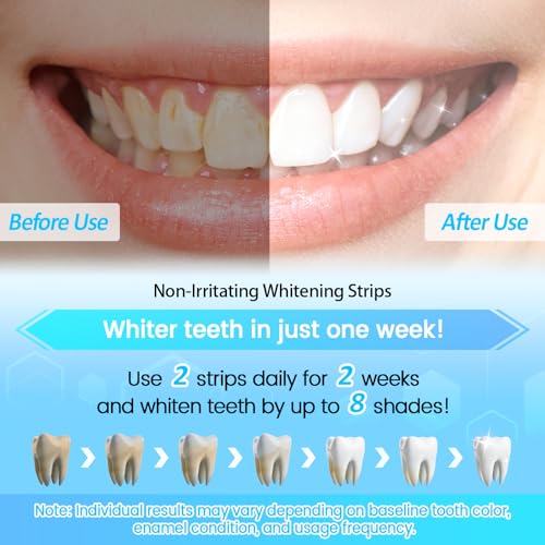 SURFOU Teeth Whitening Strips - 28 Treatments (56 Strips) - Non Peroxide Enamel Safe Kit - Gentle Mint Flavor Formula - Damaged Box - BBE 01/2028