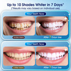 Teeth Whitening Kit with LED Light - 3 Teeth Whitening Gel Pens + 2 Remineralizing Desensitizing Gel Pens -35% Pap Whitening Formula - Whiten Teeth in 7 Days - Safe for Sensitive Teeth (Mint) - Damaged Box