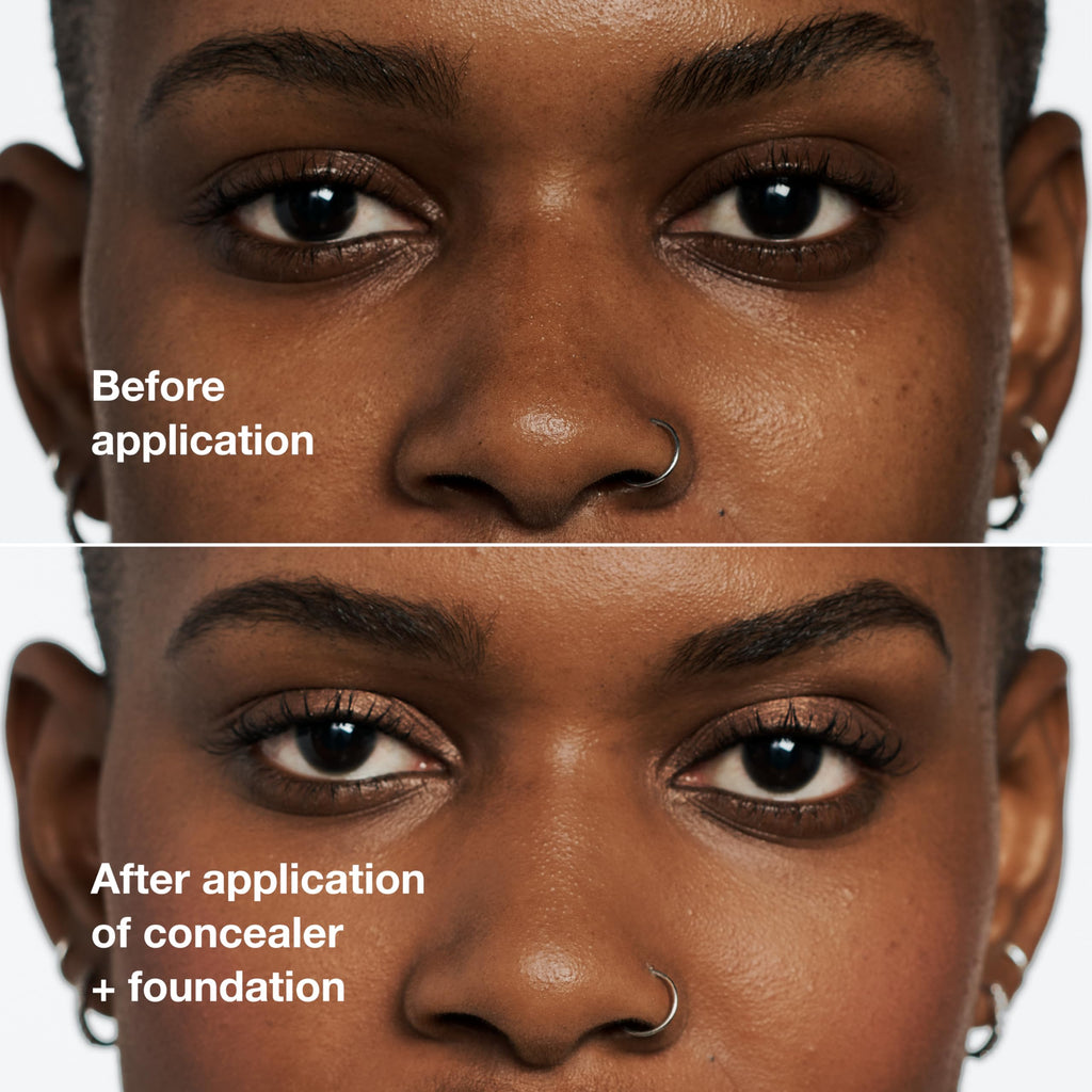 Clinique Even Better All-Over Full Coverage Concealer + Eraser For Dark Circles | Hydrating, Brightening + Depuffing - New