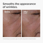 The Ordinary Multi-Peptide + Hyaluronic Acid, Anti-Aging Peptide Serum for Crow's Feet, Elasticity & Firmness, 30ml - Damaged Box