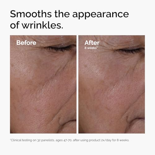 The Ordinary Multi-Peptide + Hyaluronic Acid, Anti-Aging Peptide Serum for Crow's Feet, Elasticity & Firmness, 30ml - Damaged Box
